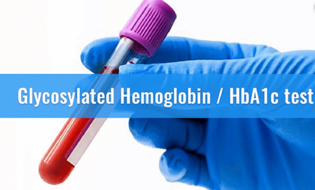 hemoglobina glikuar