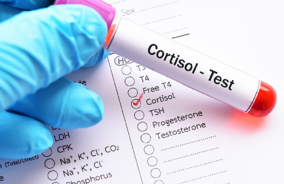 kortizol-test.jpg