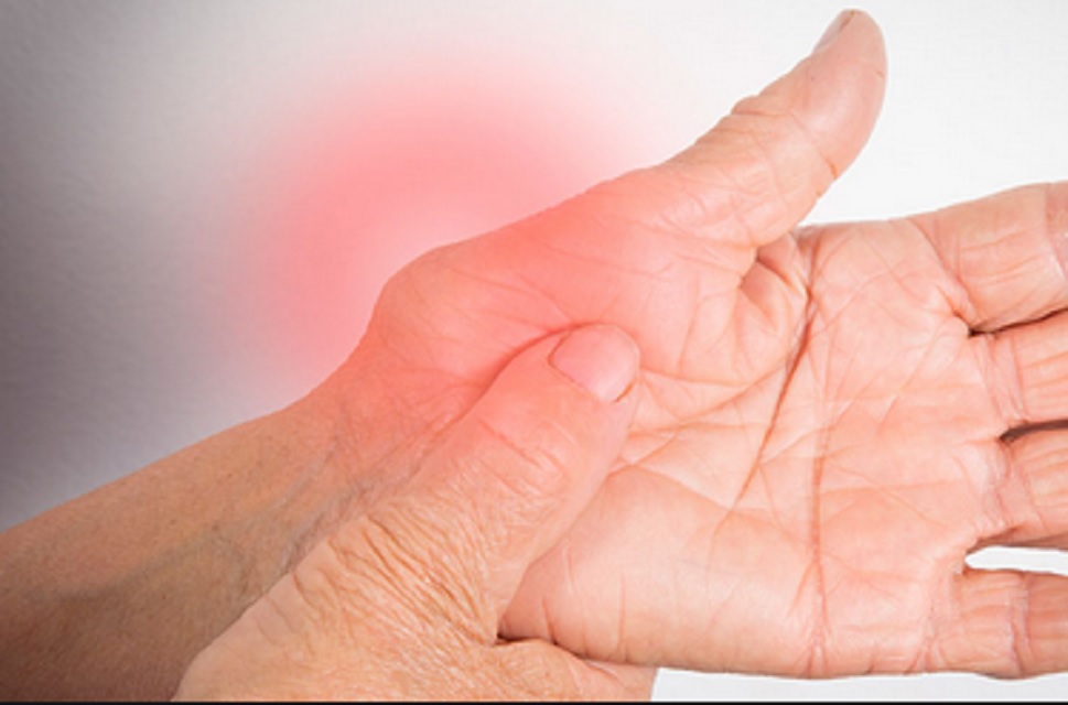 artriti reumatoid