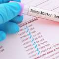 tumor marker shenues