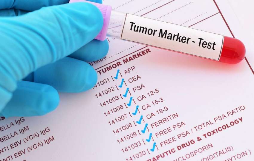 tumor marker shenues