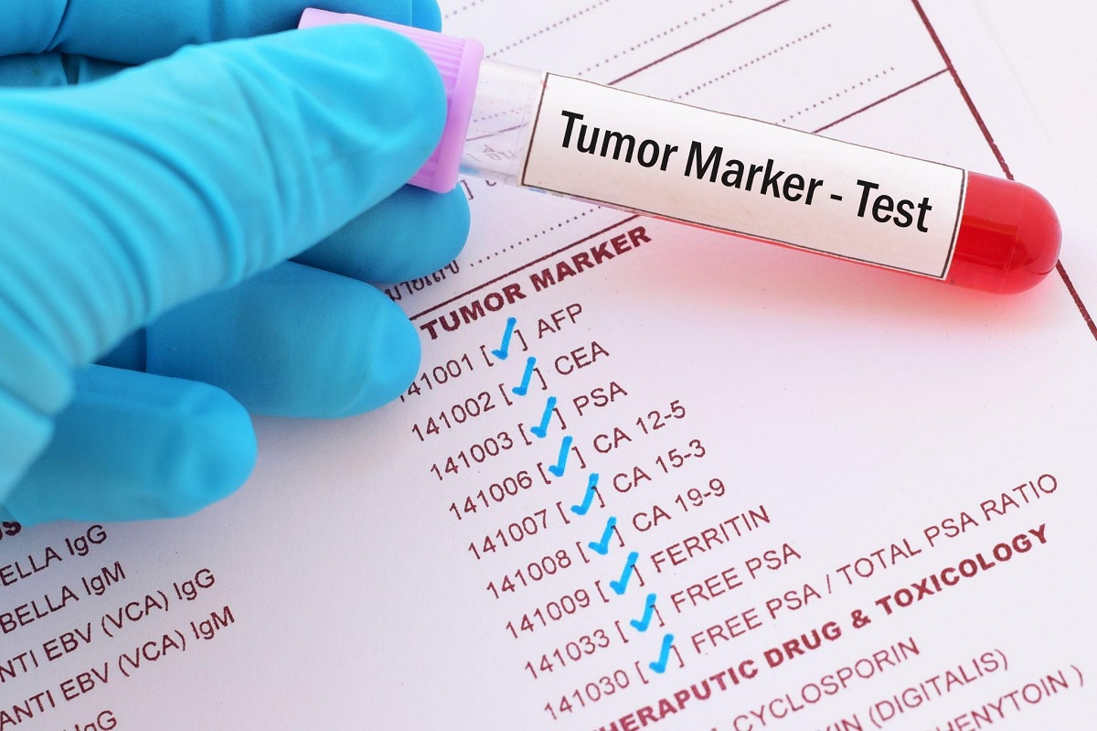 tumor marker shenues